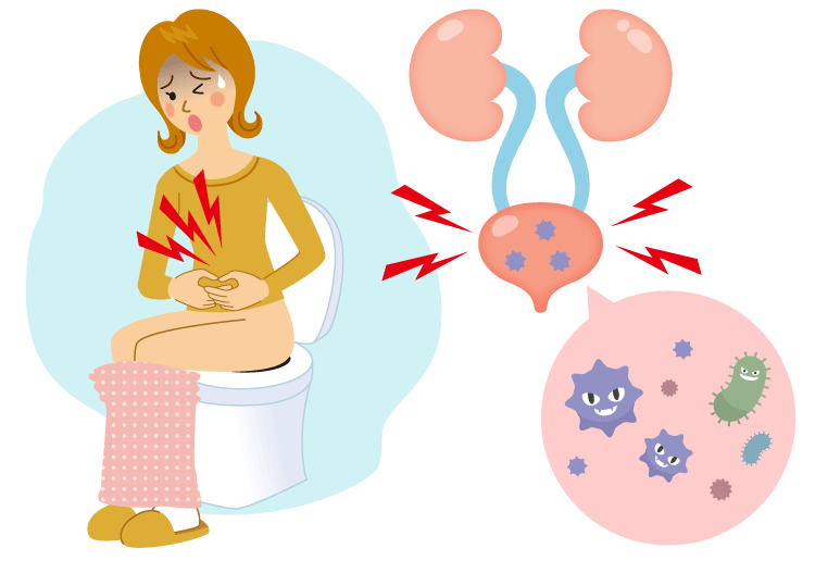 排尿時の痛み・残尿感・膀胱炎等